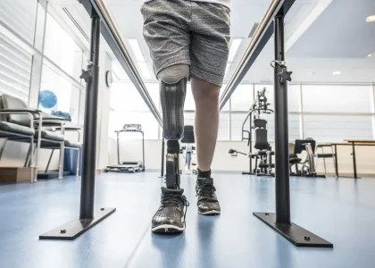 What happens when a workplace injury causes partial disability?